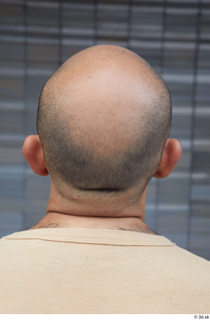 Street  692 bald hair head 0001.jpg